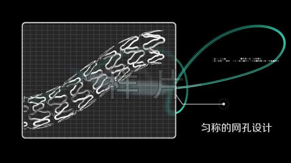 脑血管支架动画演示动画