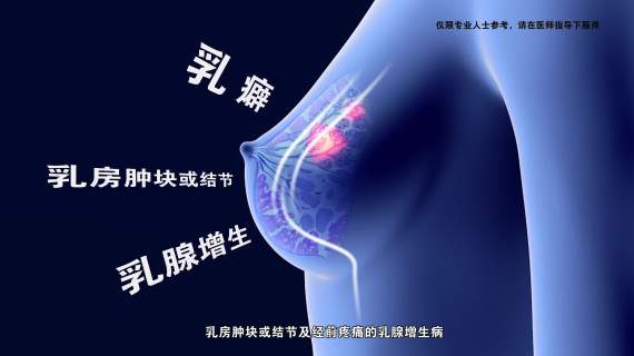 乳疾灵药品广告