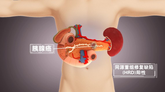 医学类基因突变三维动画案例