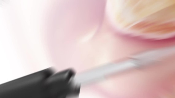 掏耳内视镜