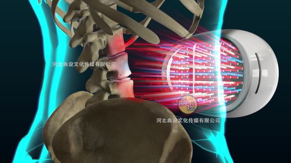 医疗类产品三维动画