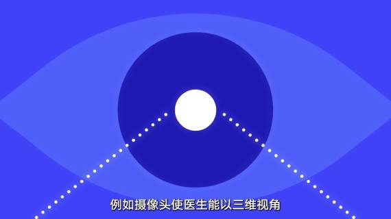 直观复星手术机器人MG动画