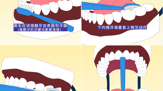 MG动画