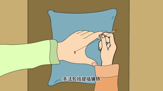 中医针灸MG科普动画